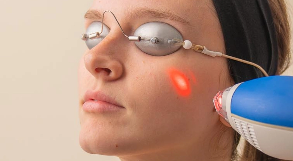 Ultimate Laser Facial